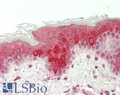IHC-plus™ VIL1 / Villin Antibody