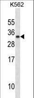 PRL / Prolactin Antibody (aa188-216)