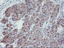 PPIL6 Antibody (clone OTI3F4)