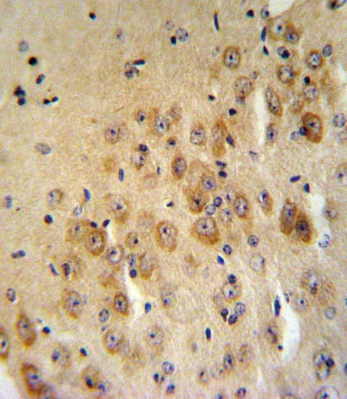 SERPINB2 / PAI-2 Antibody (aa116-144)