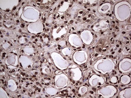 Monoclonal Mouse anti-Human SAE1 Antibody (clone OTI6B11, Carrier-free, IHC, WB)