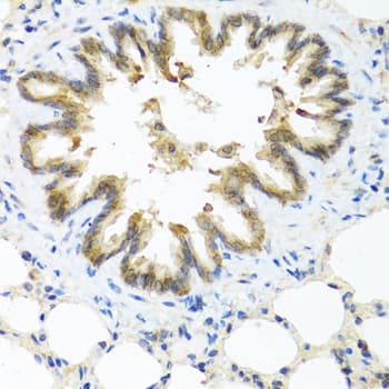 S100A7 / Psoriasin Antibody
