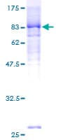 Human ACD / PTOP Protein (Recombinant GST)