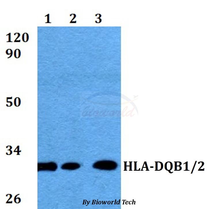 HLA-DQB1 Antibody