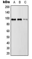 GAPIII / RASA3 Antibody (Internal)