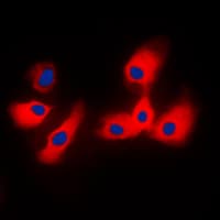 YWHAE / 14-3-3 Epsilon Antibody (C-Terminus)
