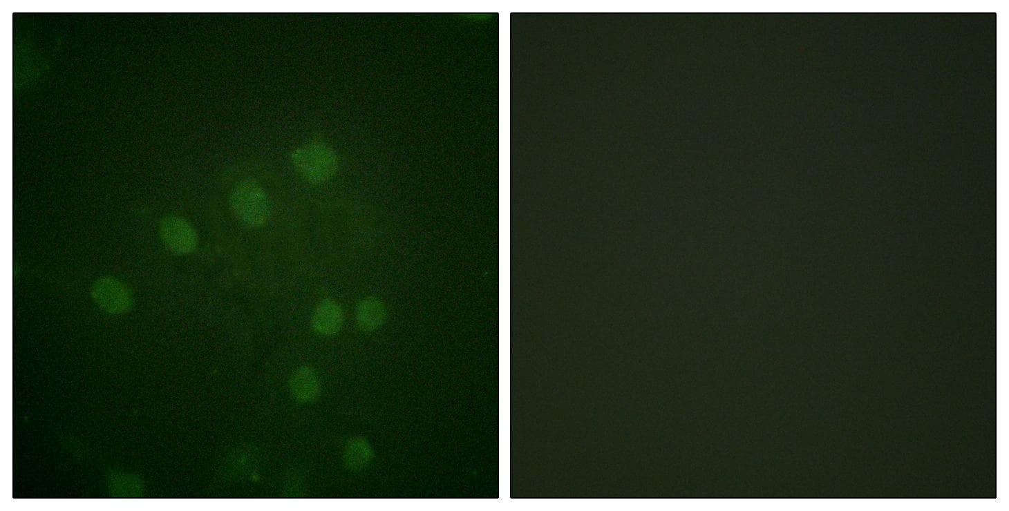 Polyclonal Rabbit anti-Human AURKB / Aurora-B Antibody (phospho-Thr232, IHC, IF, WB)