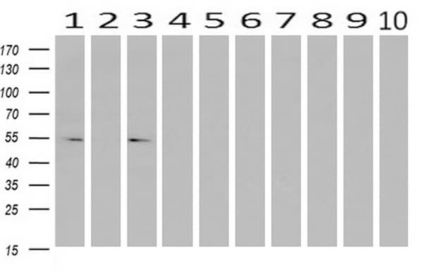 ERGIC-53 / LMAN1 Antibody (clone OTI1A8)