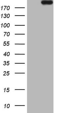 APOBR / APOB48R Antibody (aa780-1088, clone OTI2E6)
