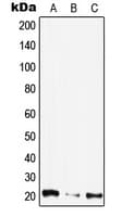 CIB4 Antibody (Internal)