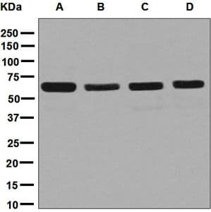 IHC-plus™ Monoclonal Rabbit anti-Human DPYSL2 / CRMP2 Antibody (clone EPR7792, C-Terminus, IHC, WB)