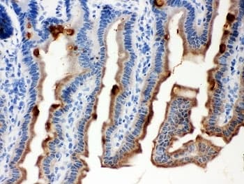 SERPINB5 / Maspin Antibody (aa1-350)