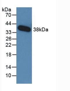 TGFB3 / TGF Beta3 Antibody