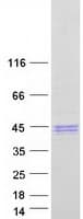 Human SHBG Protein (Recombinant Myc-DDK (Flag))