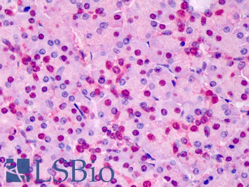 IHC-plus™ TPI1 / TPI Antibody (aa274-286)