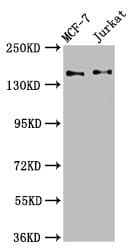 Polyclonal Rabbit anti-Human KTN1 / Kinectin Antibody (IHC, WB)