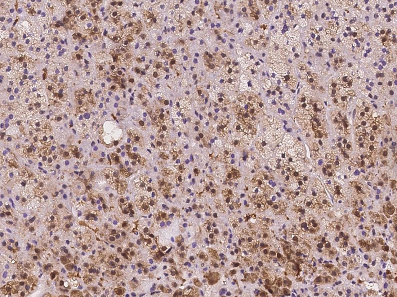 Polyclonal Rabbit anti-Human SLC7A6OS Antibody (IHC)