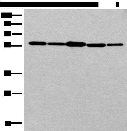 RAD23B / HR23B Antibody