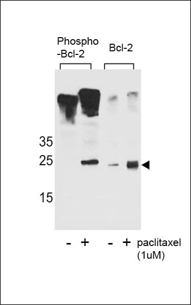 BCL2 / Bcl-2 Antibody (phospho-Ser70)