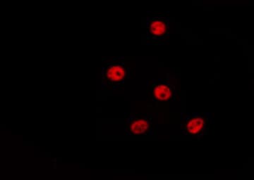 HIST3H3 Antibody (Methyl-Lys27)