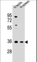 Polyclonal Rabbit anti-Human ASB17 Antibody (aa181-209, IHC, WB)