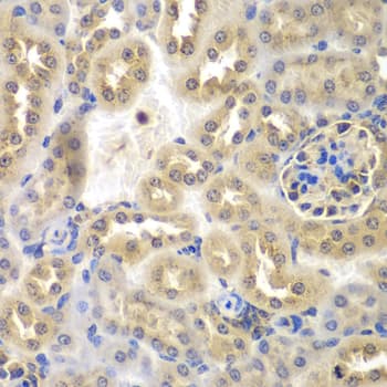 SULT2B1 / Sulfotransferase 2B1 Antibody