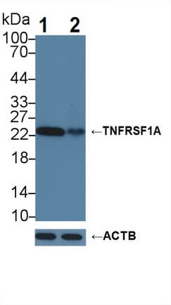 TNFRSF1A / TNFR1 Antibody (aa248-428)