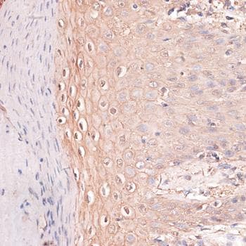 CDH3 / P-Cadherin Antibody