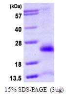 Human FAT10 / UBD Protein (Recombinant His)