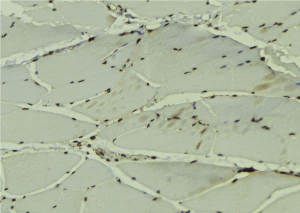 DDX42 Antibody