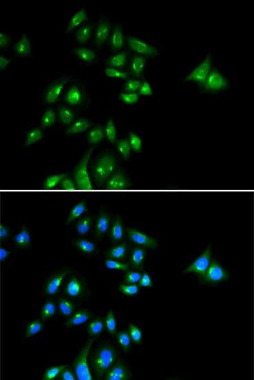 Polyclonal Rabbit anti-Human PHC3 Antibody (IF)