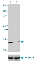 IHC-plus™ Monoclonal Mouse anti-Human B2M / Beta 2 Microglobulin Antibody (clone 3F9-2C2, IHC, IF, WB)