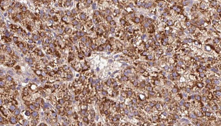 CHRNB3 Antibody