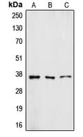 IHC-plus™ Polyclonal Rabbit anti-Human ZFP36L1 Antibody (Internal, IHC, WB)