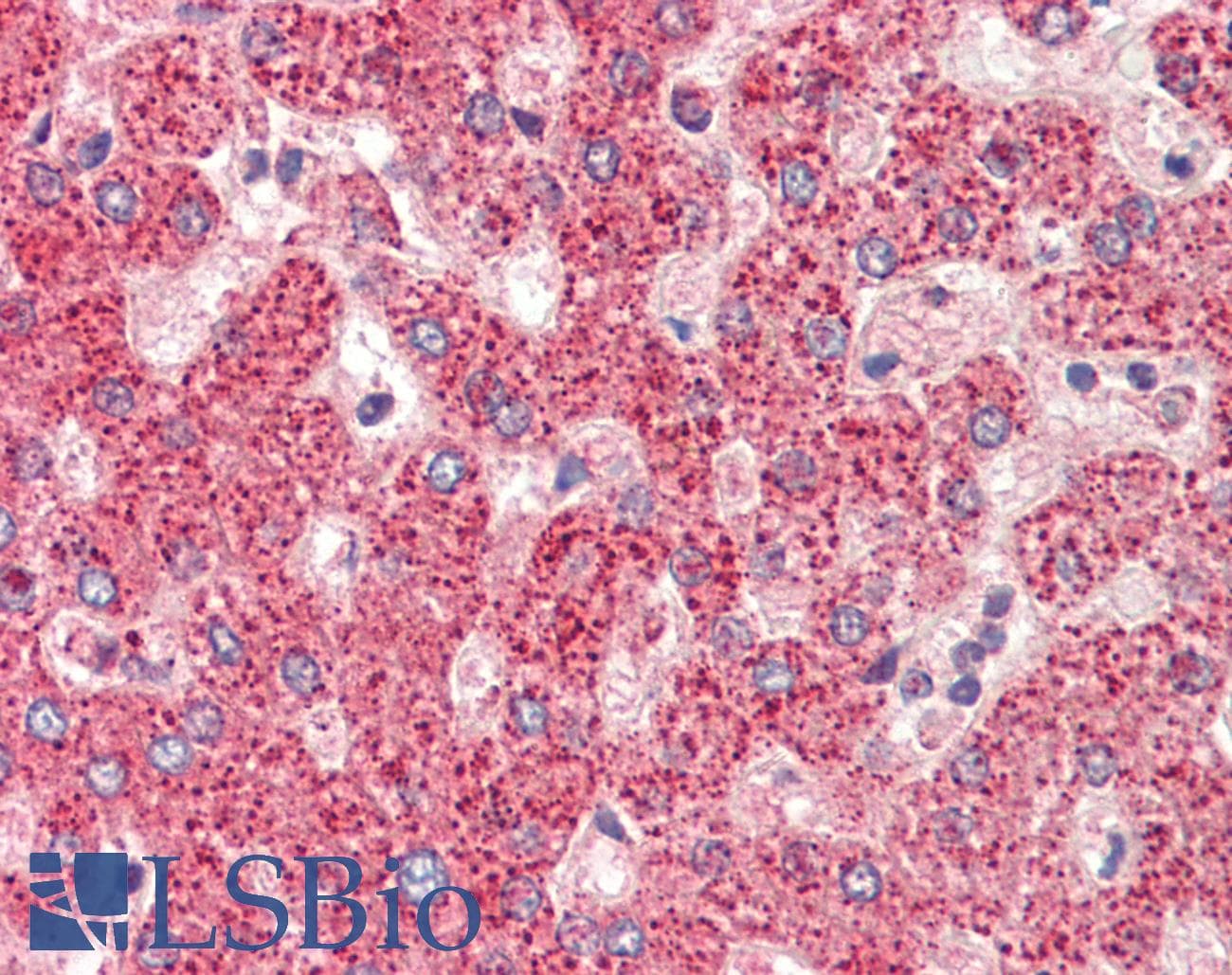 PathPlus™ Polyclonal Rabbit anti-Human ETFA Antibody (aa276-304, IHC, WB)