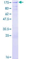 Human CBLB Protein (Recombinant GST)