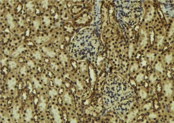 PIK3C2B Antibody