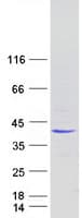 Human PIH1D3 Protein (Recombinant Myc-DDK (Flag))