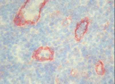 PECAM-1 / CD31 Antibody (clone MEM-05)
