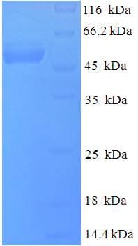 Epstein-Barr Virus BLLF3 / DUTPase Protein (Recombinant His-SUMO)