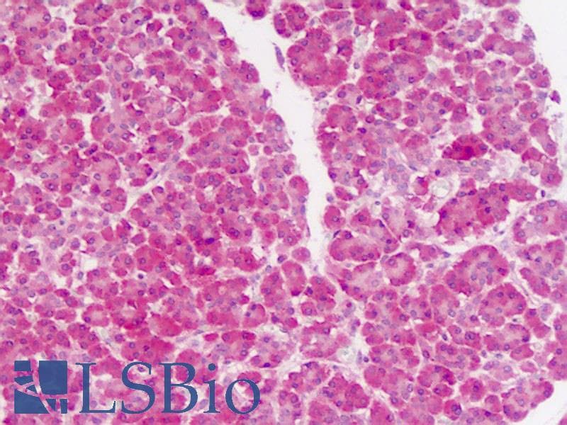 IHC-plus™ PHPT1 Antibody (aa88-117)