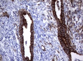 CD30 Antibody (clone OTI16H5)