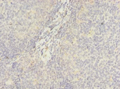 Polyclonal Rabbit anti-Human DDX42 Antibody (IHC)