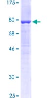 Human KRT6A / CK6A / Cytokeratin 6A Protein (Recombinant GST)