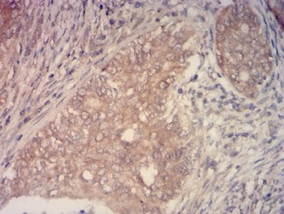 KMT2C / MLL3 Antibody (clone 6D1B9)
