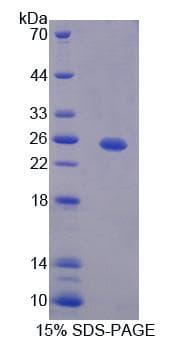 Human HPS4 Protein (Recombinant His-T7)