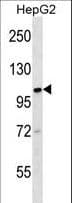 Polyclonal Rabbit anti-Human KIF18A Antibody (aa644-673, WB)