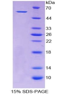 Human ALDH7A1 Protein (Recombinant His)