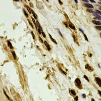 PARN Antibody