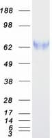 Human ENTPD3 Protein (Recombinant Myc-DDK (Flag))